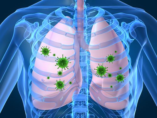 Bigstock_Lung_Infection_1913678