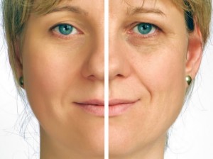 bigstock-Correction-of-wrinkles-on-half-6248301