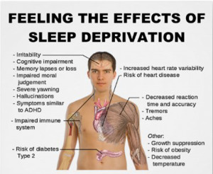 Sleep deprivation